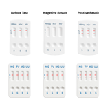 11 Panel STD Tests Kit