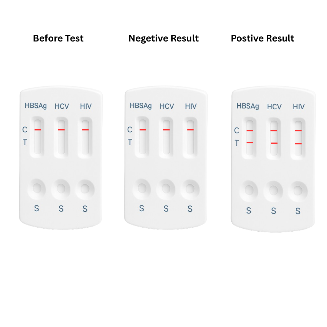 4 Panel STD Test Kits
